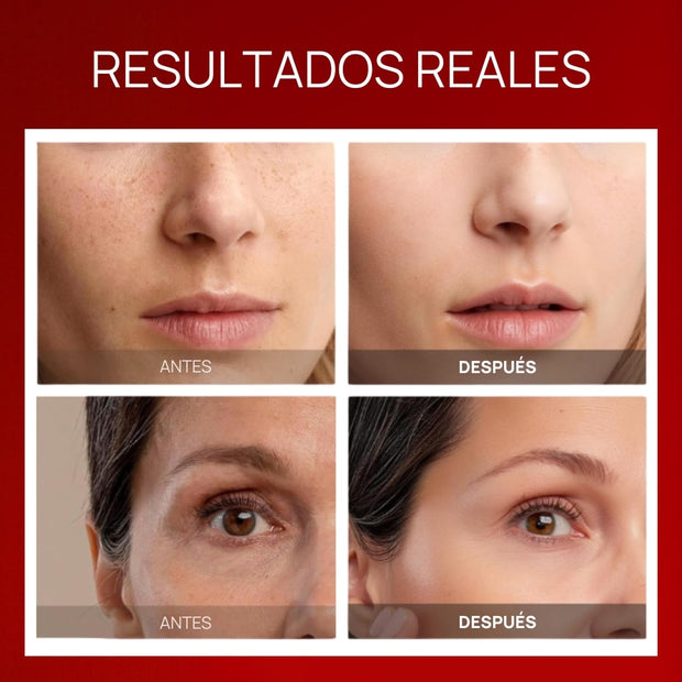 Máscara Facial LED Rejuvenecedora | Terapia Antiedad, Antiacné y Reafirmante
